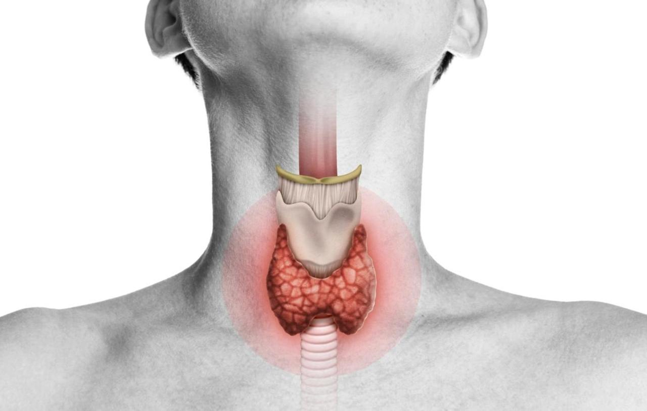 видалення щитовидки